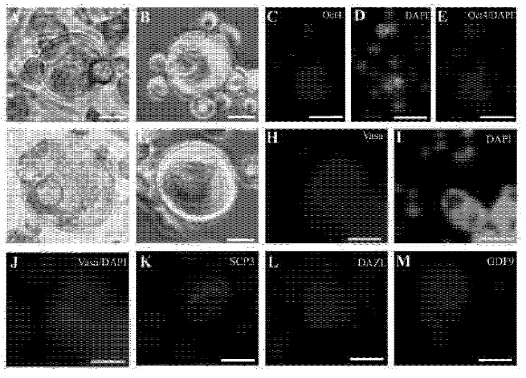 Figure 4: early follicle-like structures and oocyte-like cells in MCA-induced hBMDCs