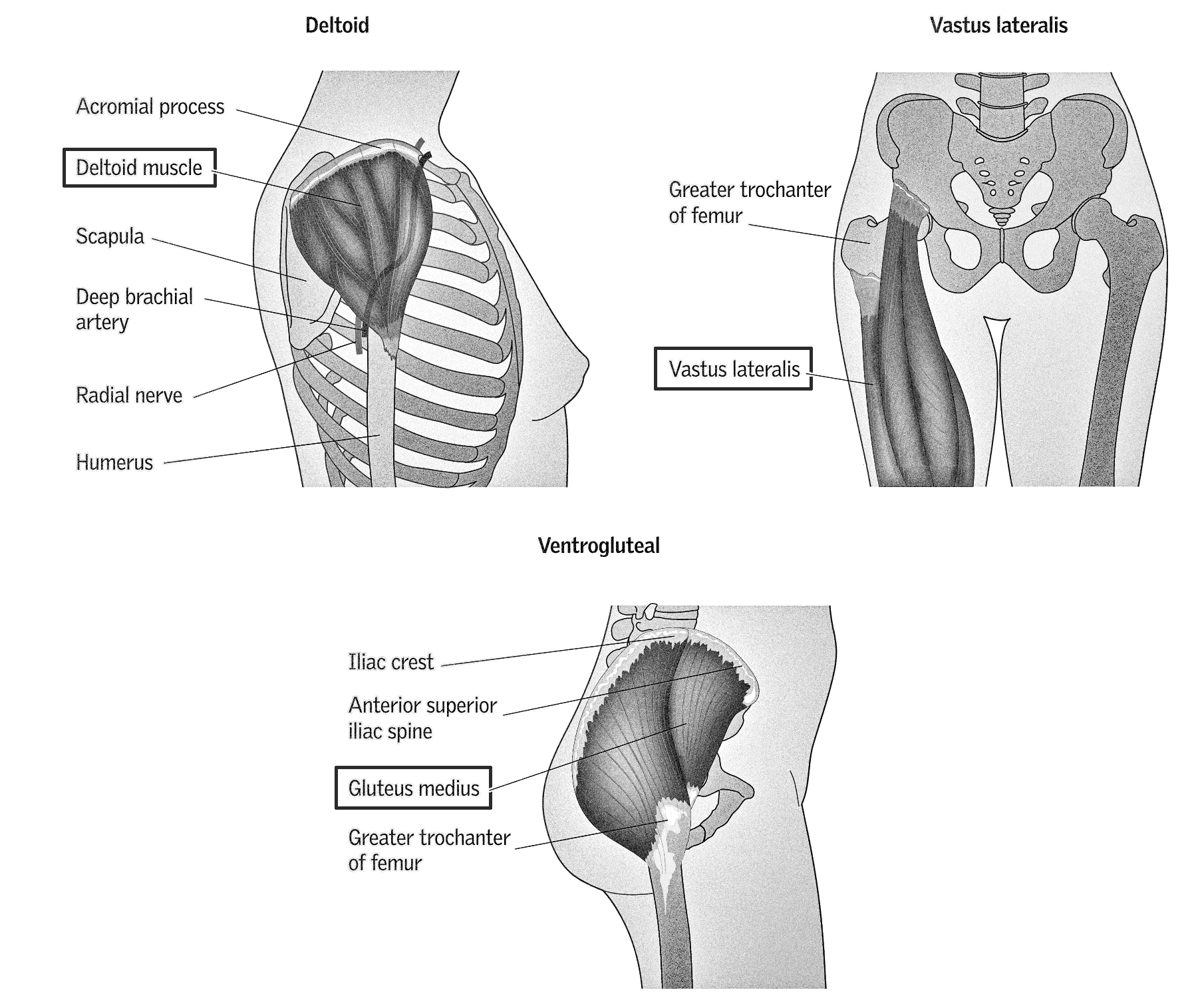 Illustration depicting intramuscular injection sites around the body, including on shoulders in the deltoid muscles, on thighs in the vastus lateralis, and ventrogluteal on the side of hips in the gluteus medius muscle.