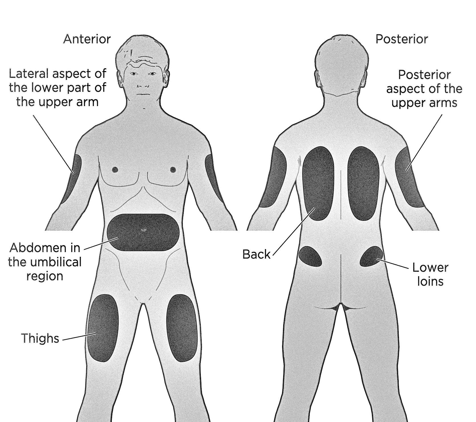 Illustration depicting subcutaneous injection sites located around the human body. Anterior sites are shown on the left including the lateral aspect of the lower part of the upper arm, the abdomen in the umbilical region, and thighs. Posterior sites are shown on the right including the posterior aspect of the upper arm, back, and lower loins.